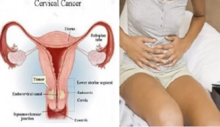 Multe persoane nu acorda o atentie suficienta simptomelor ce ar putea indica prezenta celulelor canceroase in corp